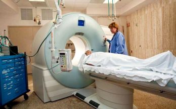 CT Scans – responsible for DNA damage?