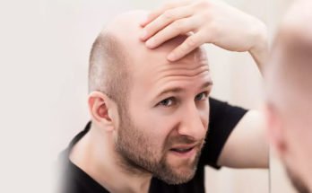 Understanding the reasons for hair fall, internal and external, and solving it