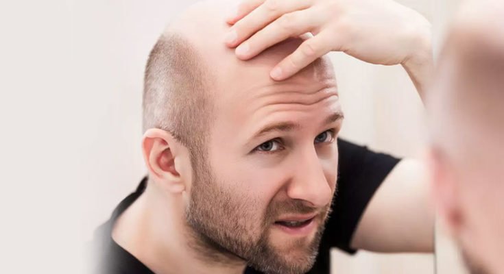 Understanding the reasons for hair fall, internal and external, and solving it